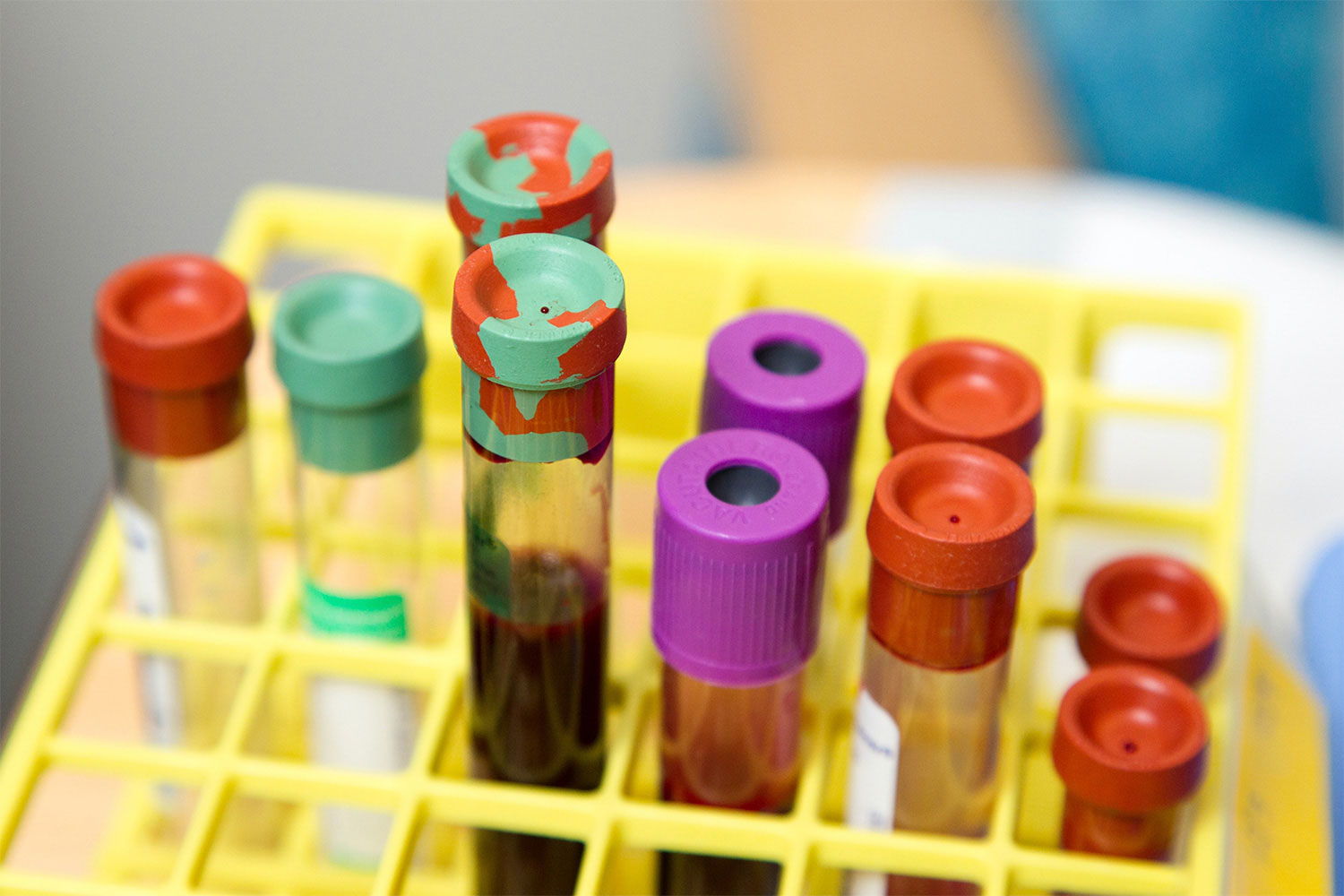 How blood can help diagnose cancer early 2 science post how blood can help diagnose cancer early image 01 How blood can help diagnose cancer early